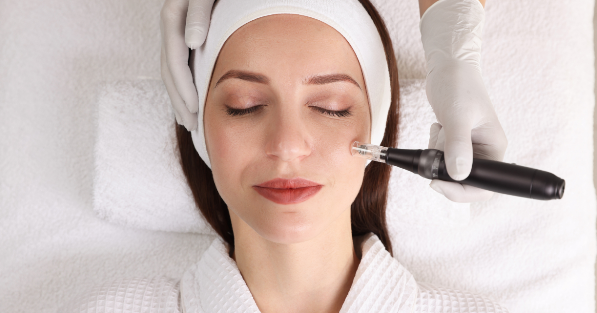 Is microneedling goed voor je huid