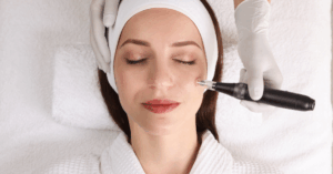 Is microneedling goed voor je huid? Alles wat je moet weten