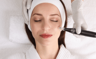 Is microneedling goed voor je huid